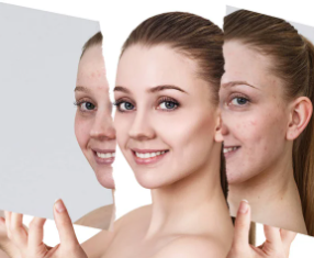 ग्लोइंग स्किन